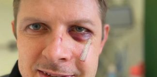 Selfie aus dem Krankenhaus: leicht verletzter SPD-Europaabgeordneter Matthias Ecke.