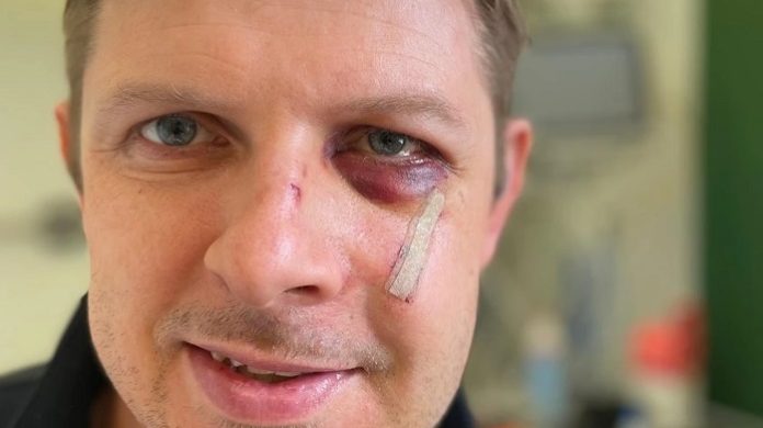 Selfie aus dem Krankenhaus: leicht verletzter SPD-Europaabgeordneter Matthias Ecke.